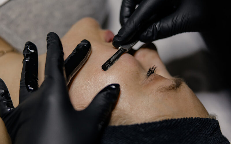 Dermaplaning in North logan UT |